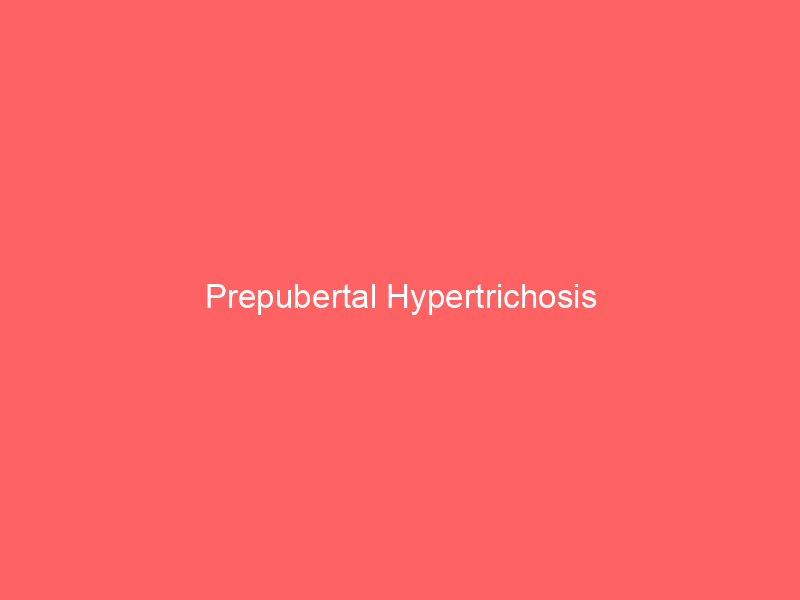 Prepubertal Hypertrichosis
