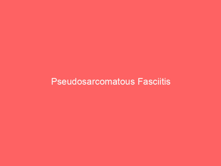 Pseudosarcomatous Fasciitis