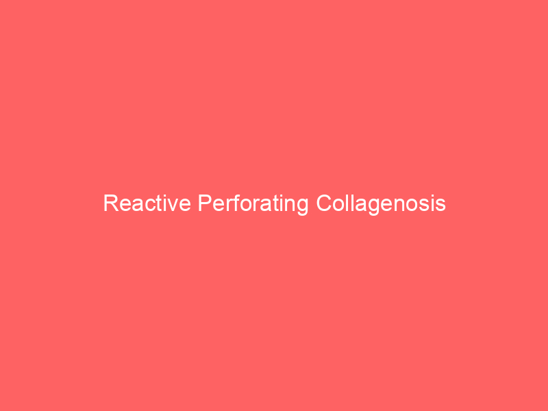 Reactive Perforating Collagenosis