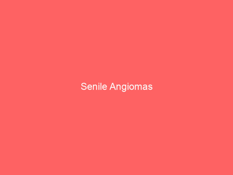 Senile Angiomas