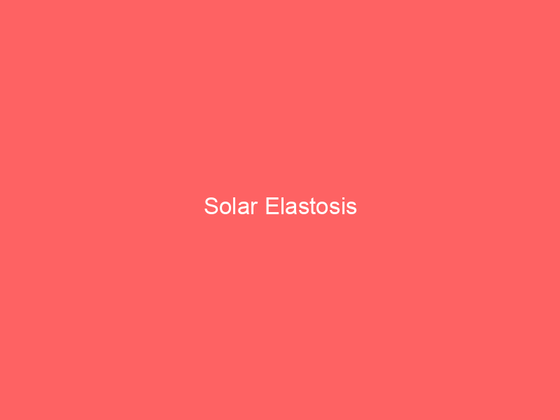 Solar Elastosis