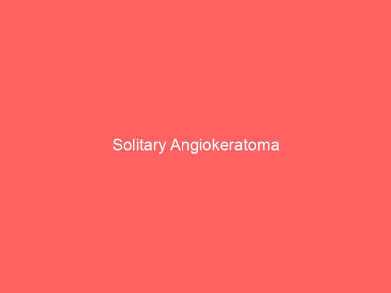 Solitary Angiokeratoma
