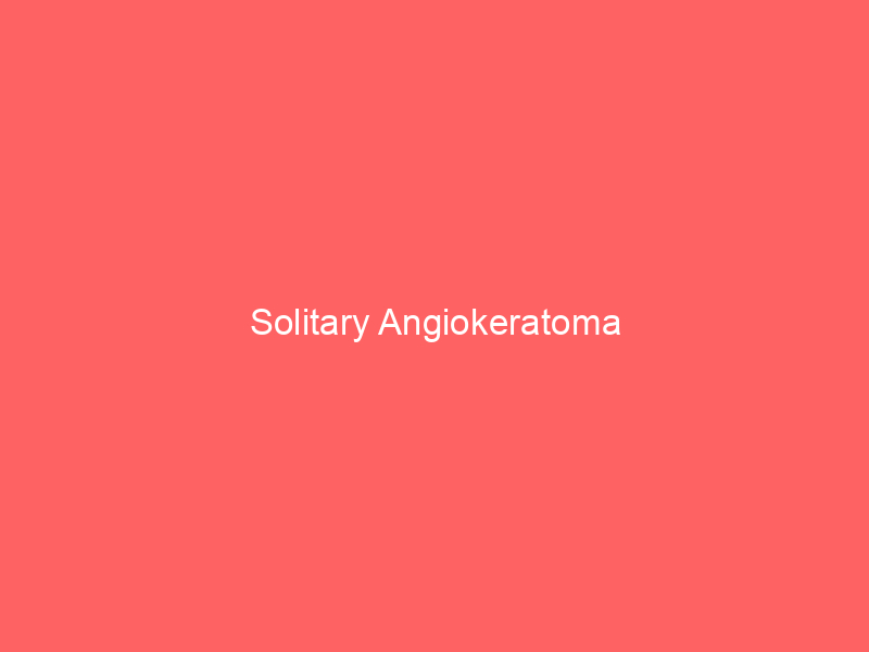 Solitary Angiokeratoma