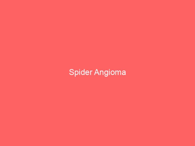 Spider Angioma