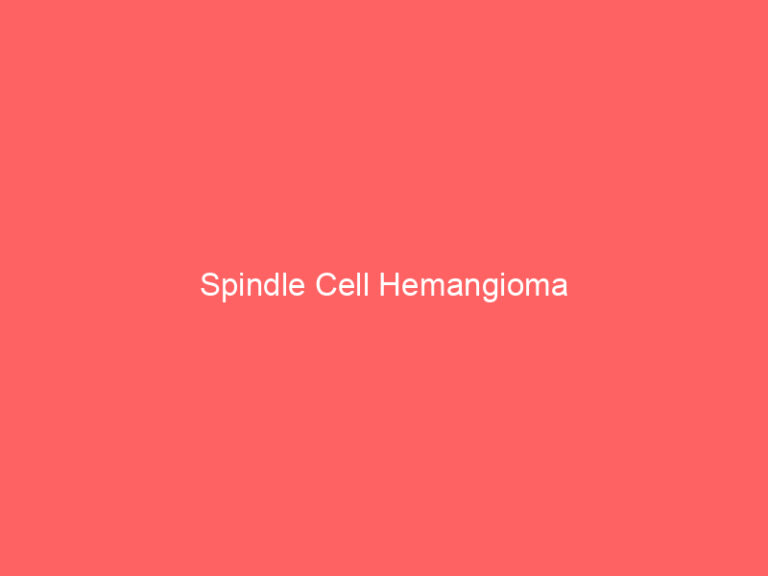 Spindle Cell Hemangioma