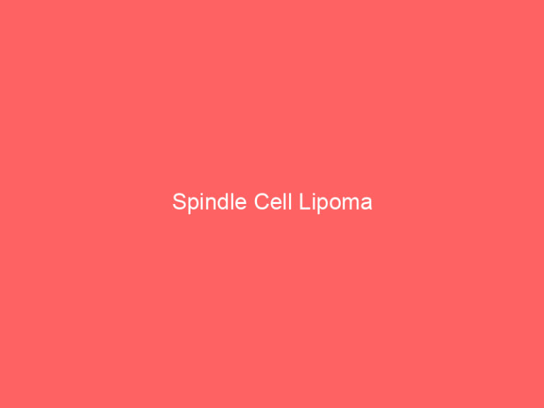 Spindle Cell Lipoma