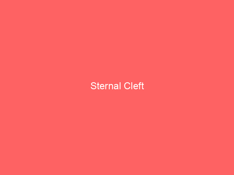 Sternal Cleft