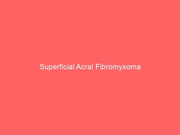 Superficial Acral Fibromyxoma