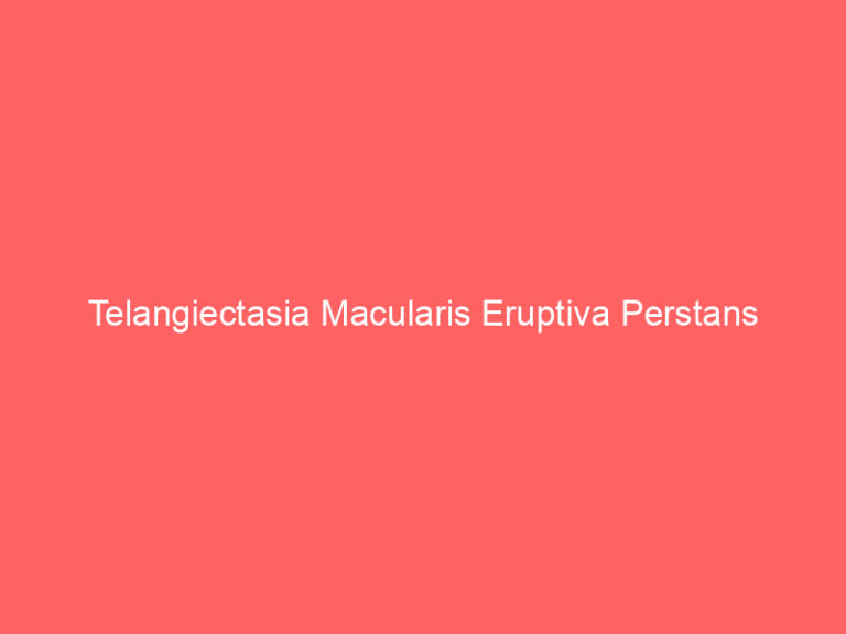 Telangiectasia Macularis Eruptiva Perstans