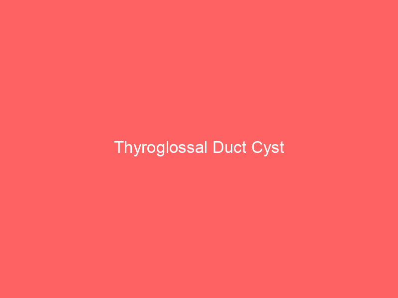 Thyroglossal Duct Cyst