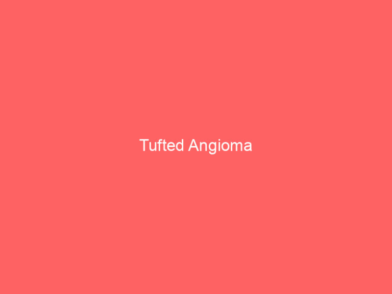 Tufted Angioma