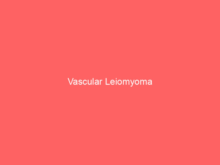 Vascular Leiomyoma