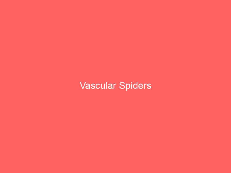 Vascular Spiders