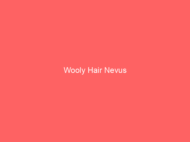 Wooly Hair Nevus