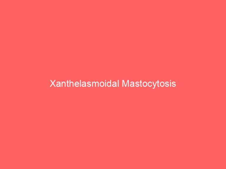 Xanthelasmoidal Mastocytosis