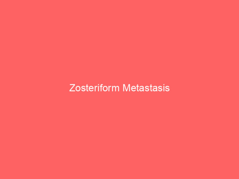 Zosteriform Metastasis