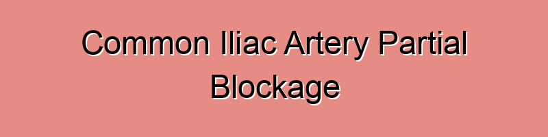 Common Iliac Artery Partial Blockage