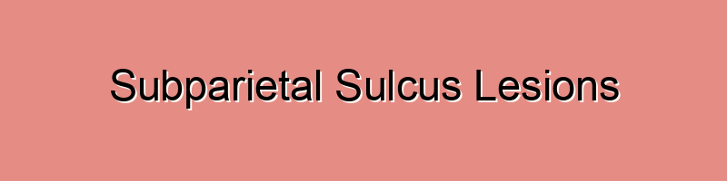 Subparietal sulcus lesions refer to abnormalities or damage occurring ...