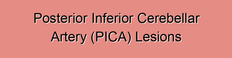 Posterior Inferior Cerebellar Artery (PICA) Lesions