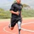 Amputation Causes, Symptoms, Treatment, Rehabilitation