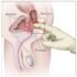 Cervical Nerves – Anatomy, Nerve Supply, Functions