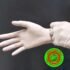 Test Diagnosis of Biceps Tear, Recovery
