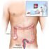 Anusitis – Causes, Symptoms, Diagnosis, Treatment