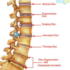 Prolapsed Disc – Causes, Symptoms, Diagnosis, Treatment