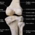 What Is Knee Dislocation? – Causes, Symptoms, Treatment