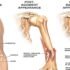 Elbow Trauma – Causes, Symptoms, Diagnosis, Treatment