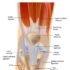 How is bursitis of the kneecap treated?