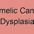 Campomelic Dwarfism