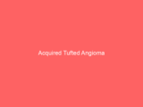 Acquired Tufted Angioma