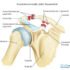 How Do I Treat an Injured Scapula, Relieve Pain