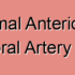 Paramedian Anterior Inferior Temporal Artery Stroke