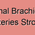 Thromboembolic Brachiocephalic Arteries Stroke