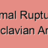 Non-Aneurysmal Stenosis of the Subclavian Artery