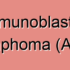 Nasal T-Cell Lymphoma