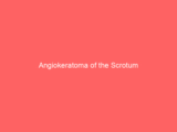 Angiokeratoma of the Scrotum