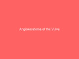 Angiokeratoma of the Vulva
