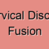 Posterior Cervical Fusion