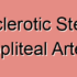 Degenerative Stenosis of the Popliteal Artery