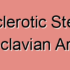 Degenerative Stenosis of the Subclavian Artery