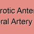 Cardiogenic Anterior Inferior Temporal Artery Stroke
