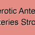 Atherosclerotic Stenosis of Anterior Spinal Arteries Stroke