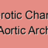 Atherosclerotic Stenosis of Aortic Arc
