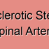 Atherosclerotic Anterior Spinal Arteries Stroke