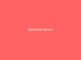 Carcinoid tumors