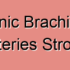 Thromboembolic Brachiocephalic Arteries Stroke