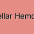 Basal Ganglia Hemorrhage